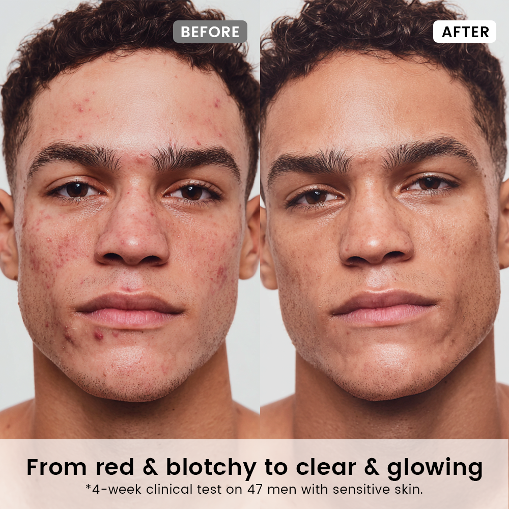 Alra Olive Therapy Serum