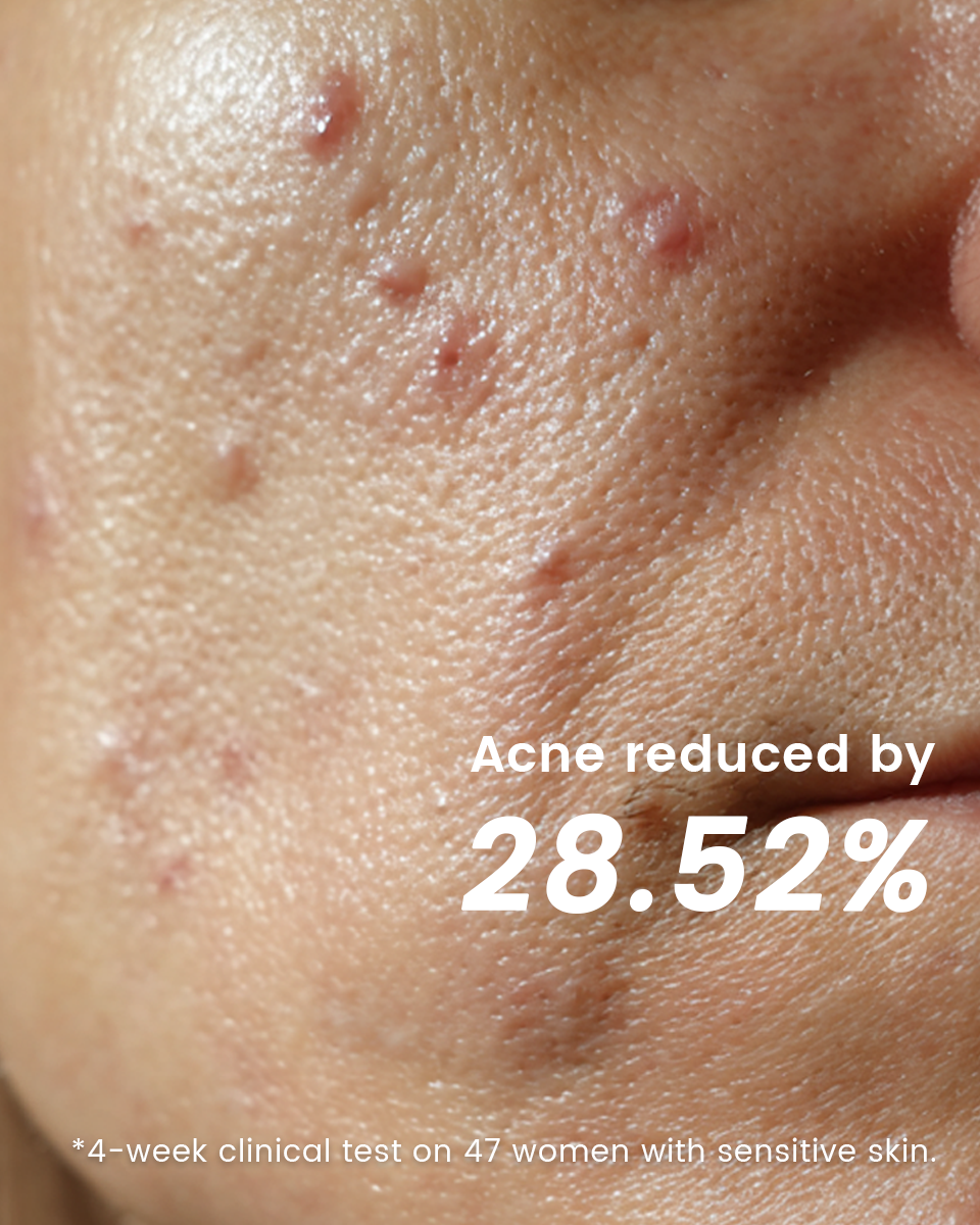 Alra Skin Care