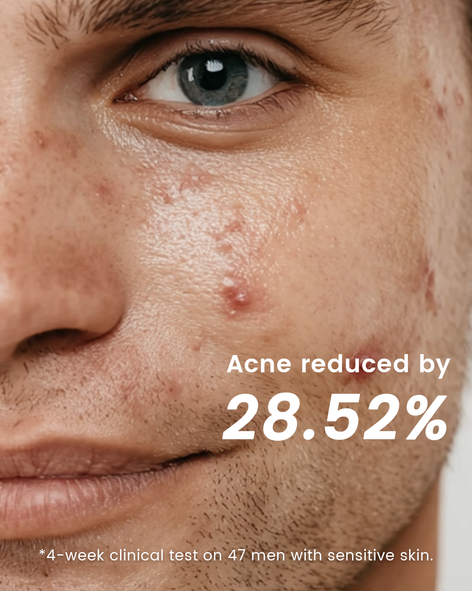 Alra Skin Care