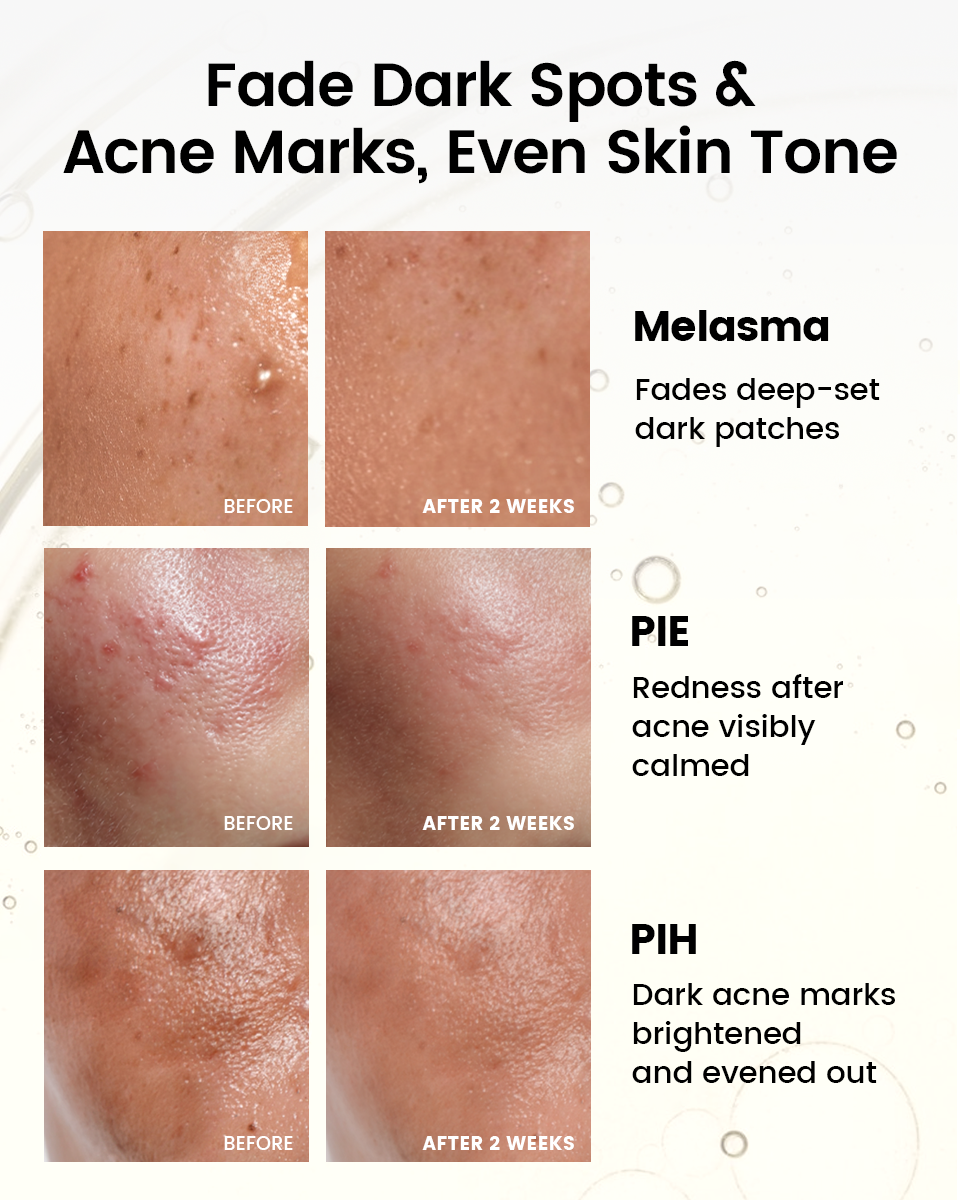 Alra Skin Care