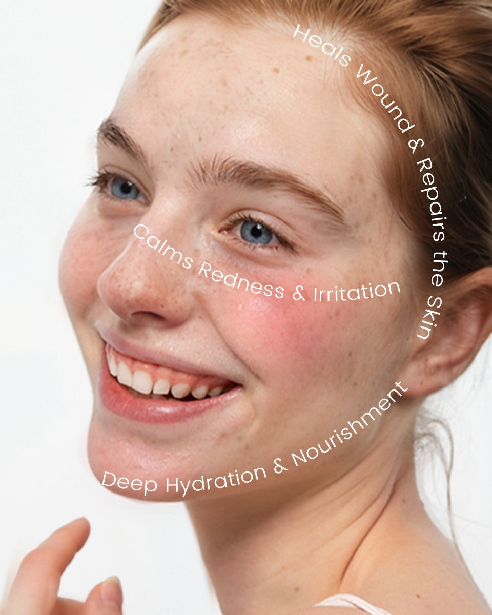 Graphic showing three skincare benefits under the title “Repair & Soothing Care”: Heals Wounds & Repairs the Skin, Deep Hydration & Nourishment, and Calms Redness & Irritation — representing the soothing and restorative effects of Alra Olive Serum.