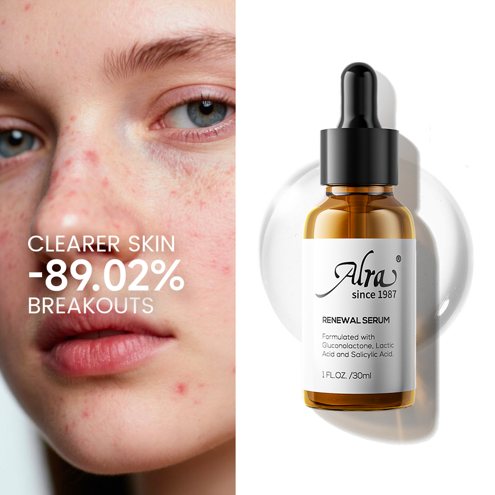 How to Smooth Rough, Uneven Skin Texture Without Harsh Peels