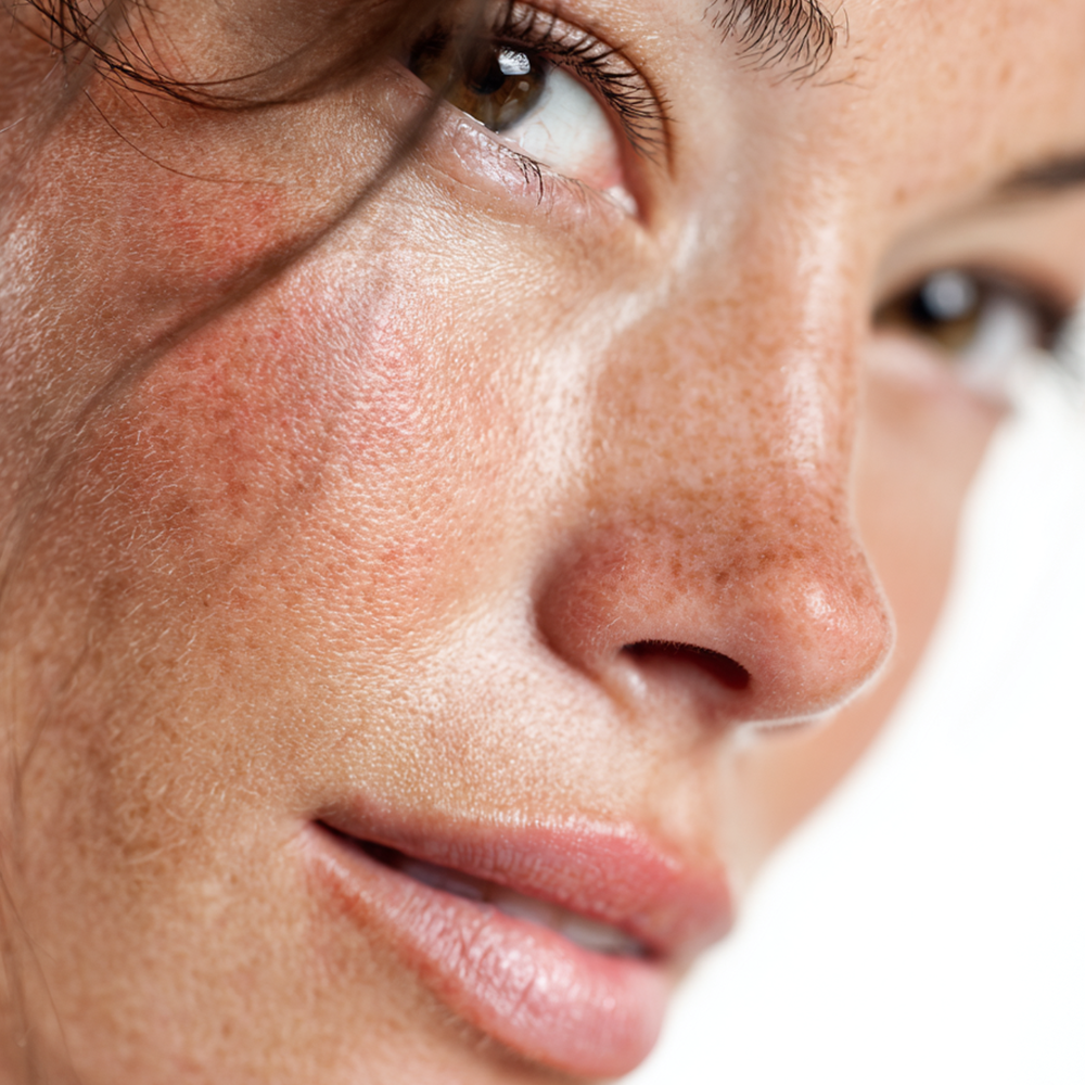 How to Smooth Rough, Uneven Skin Texture Without Harsh Peels