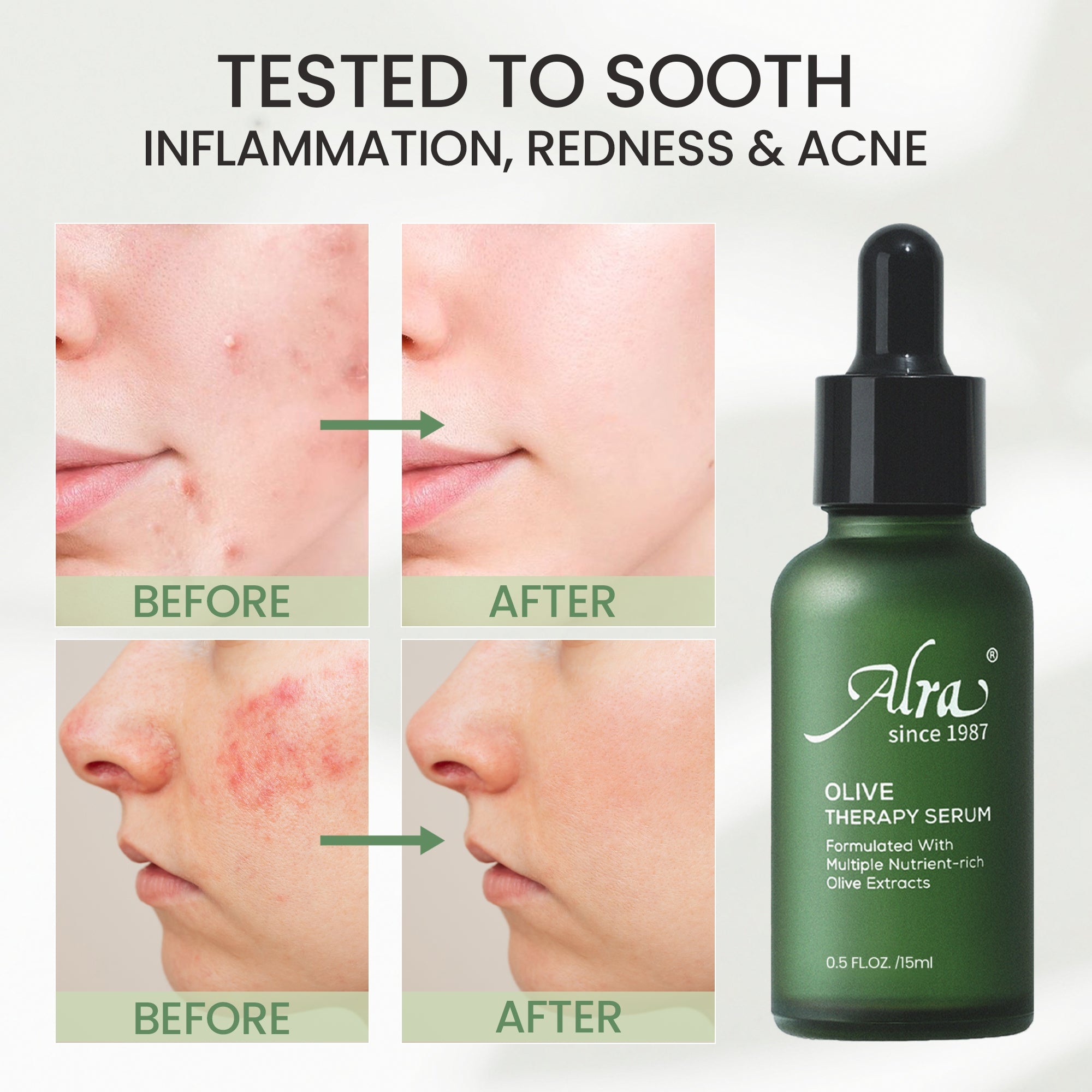 Alra Olive Therapy Serum - Alra Skin Care