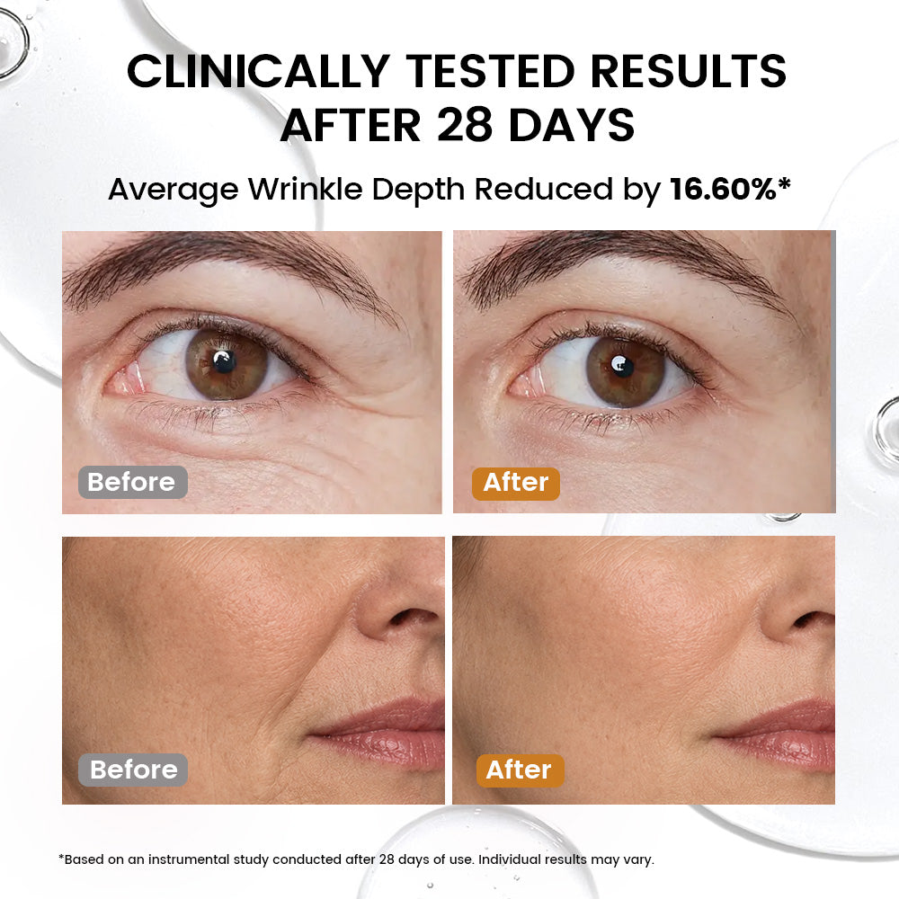 Alra Renewal Serum