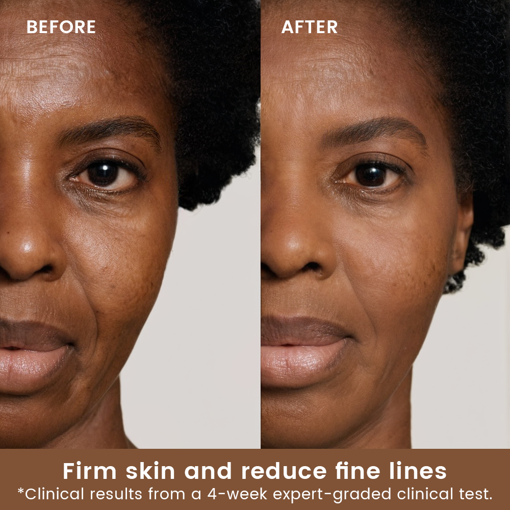 Alra Anti-aging Set