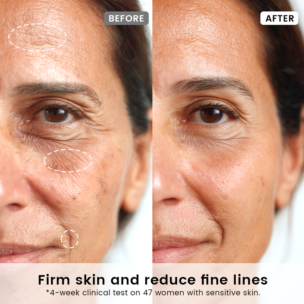 Alra Anti-aging Set
