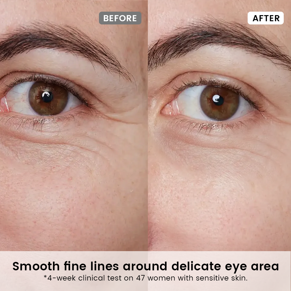 Alra Anti-aging Set