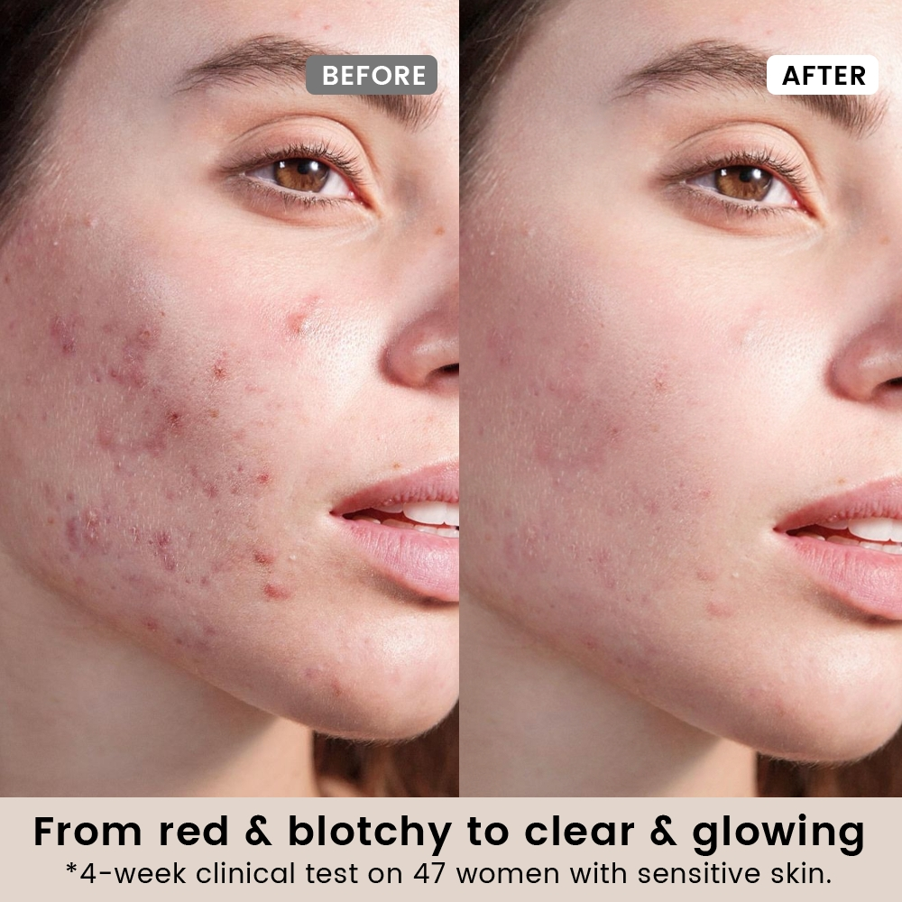 Alra Tone Correcting Therapy Serum