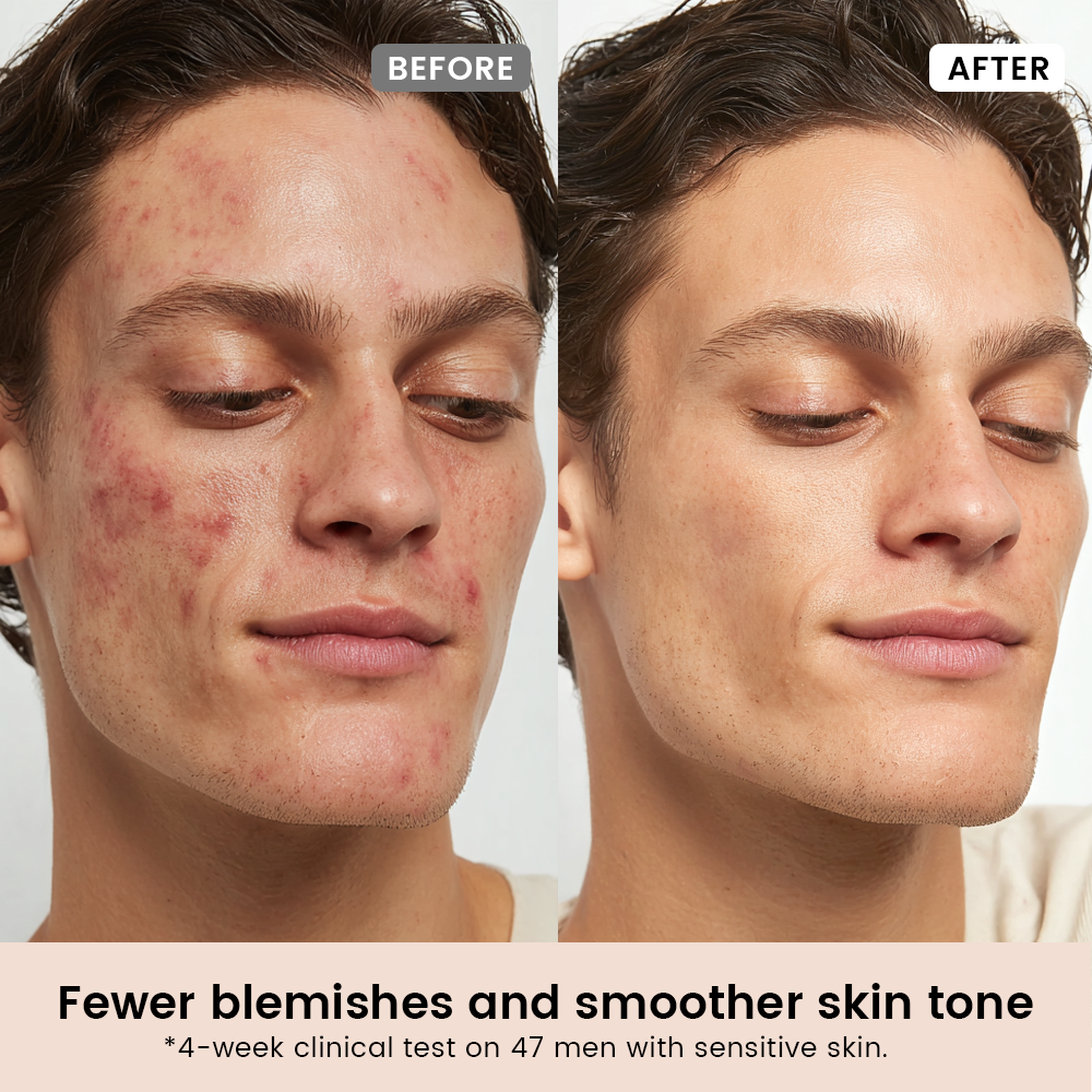 Alra PHA Serum