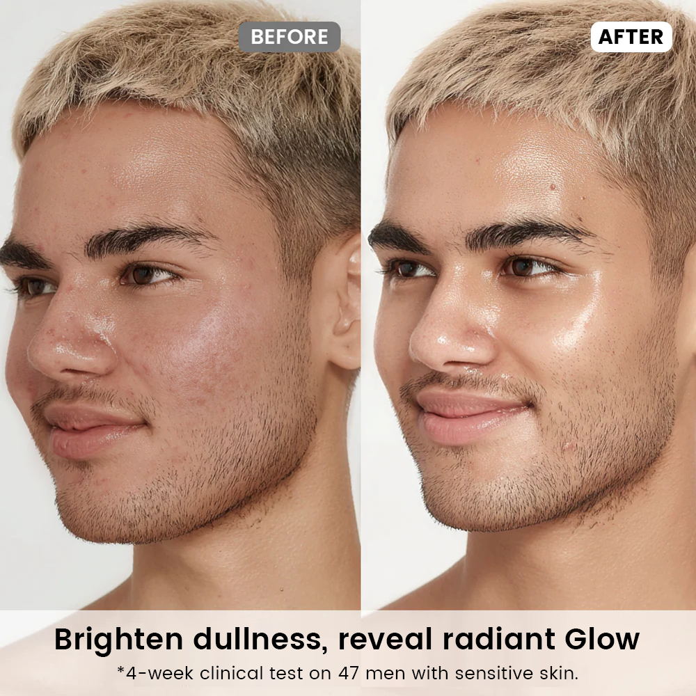 Radiance Recovery Set