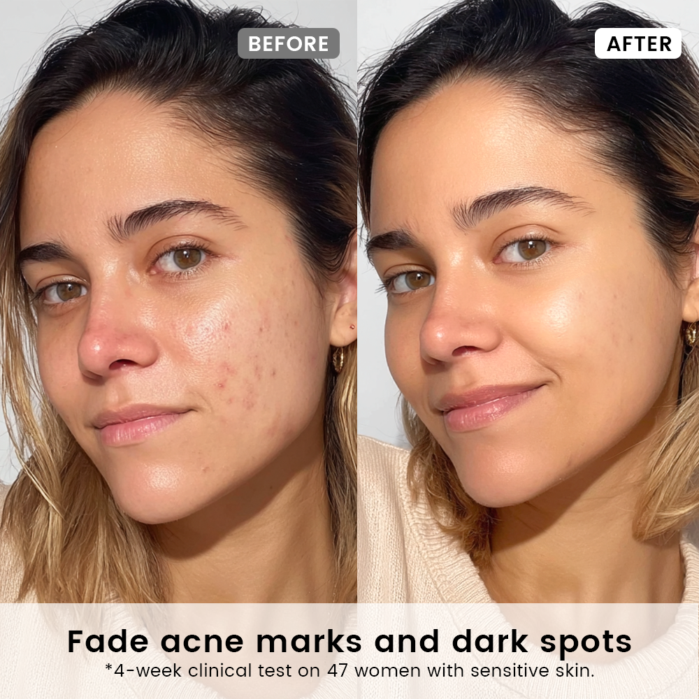 Alra Renewal Serum