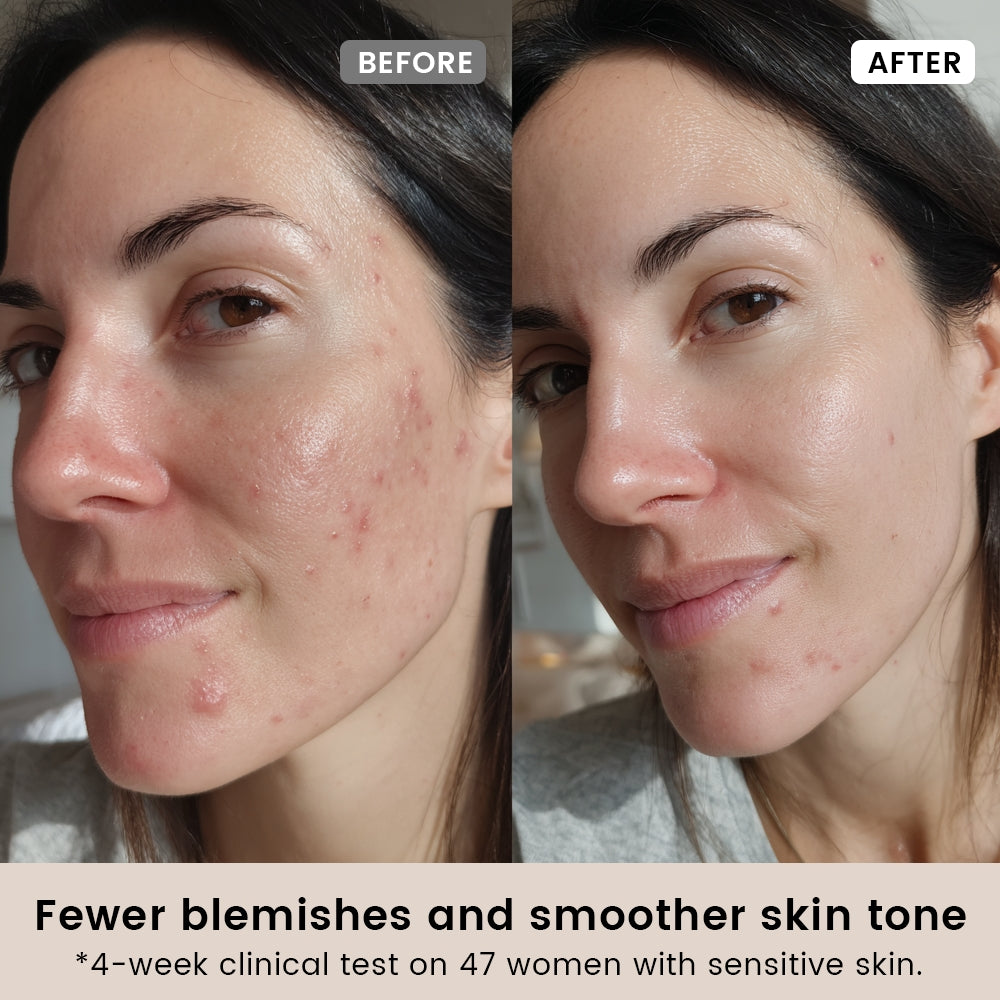 Alra Renewal Serum