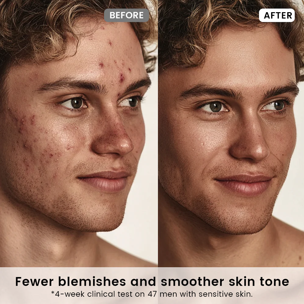 Alra Blemish Rescue Set