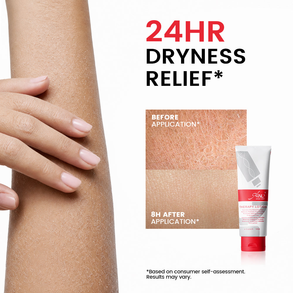 Alra_Therapy_Lotion_provides_24-hour_relief_from_dryness.
