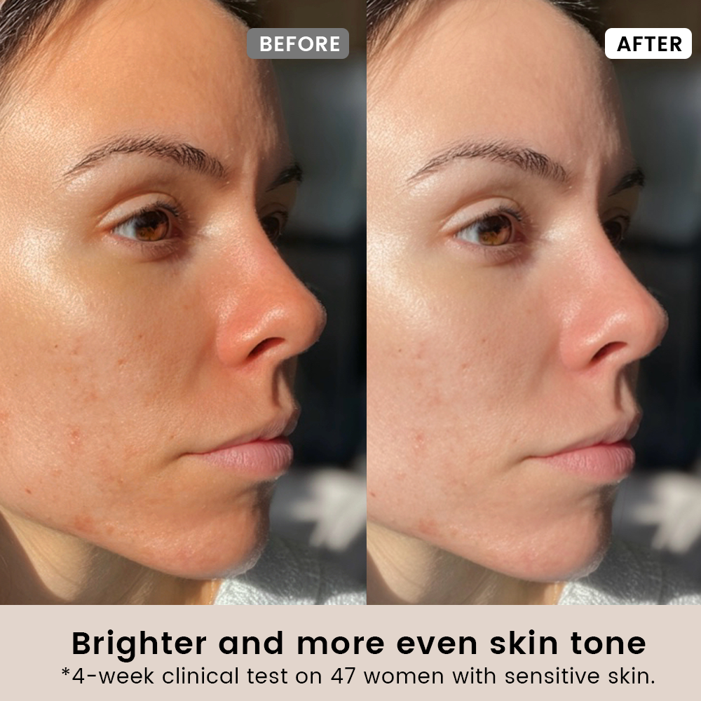 SUPRAMOLECULAR VITAMIN-C THERAPY SERUM