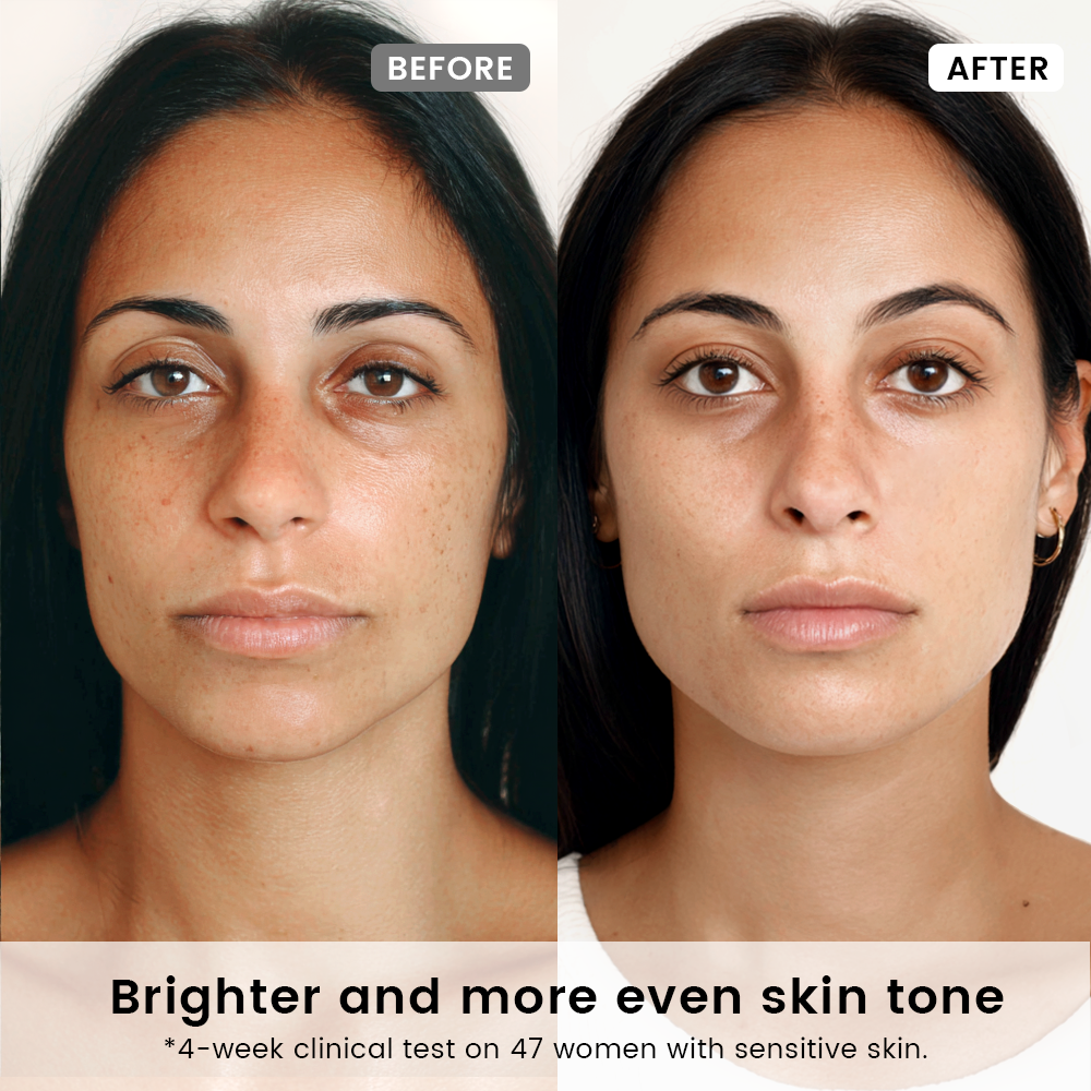 SUPRAMOLECULAR VITAMIN-C THERAPY SERUM