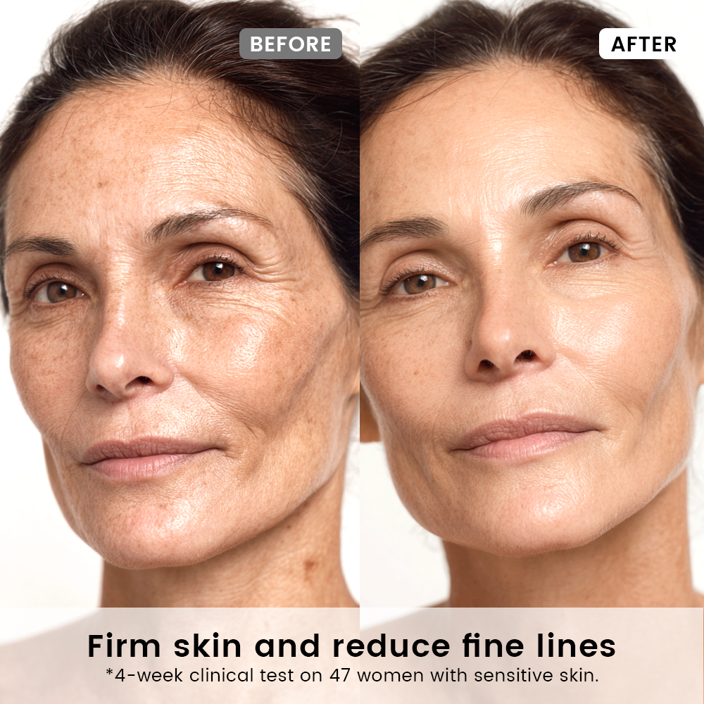 SUPRAMOLECULAR VITAMIN-C THERAPY SERUM