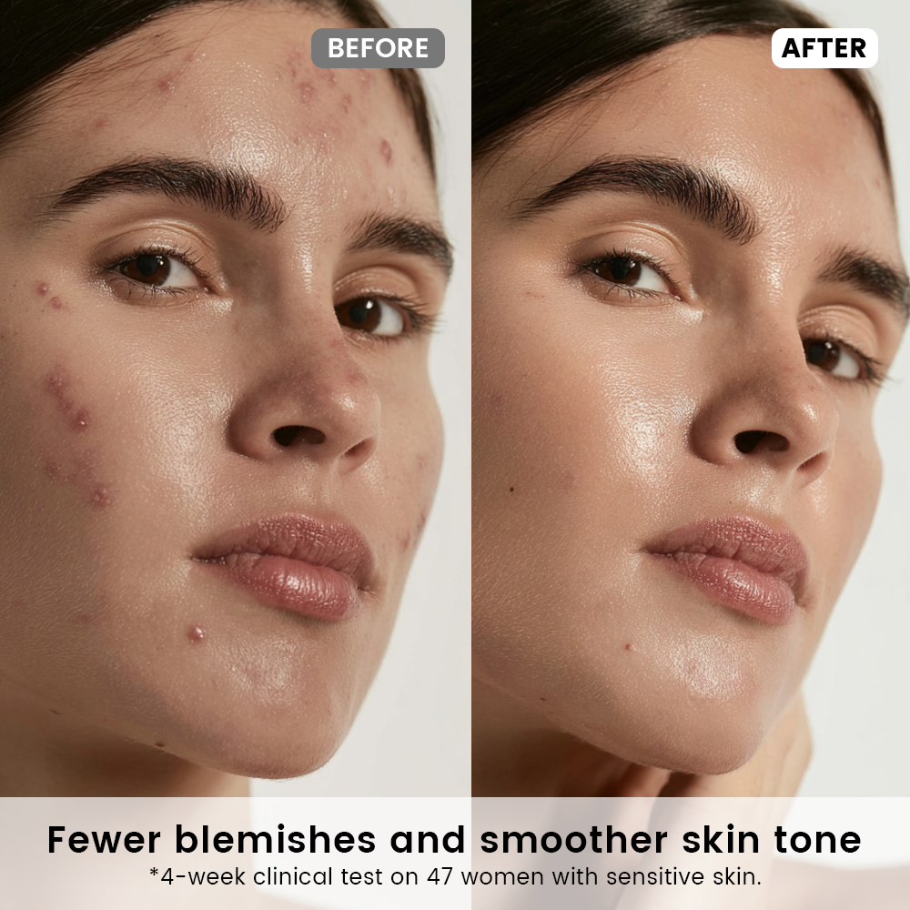 Radiance Recovery Set