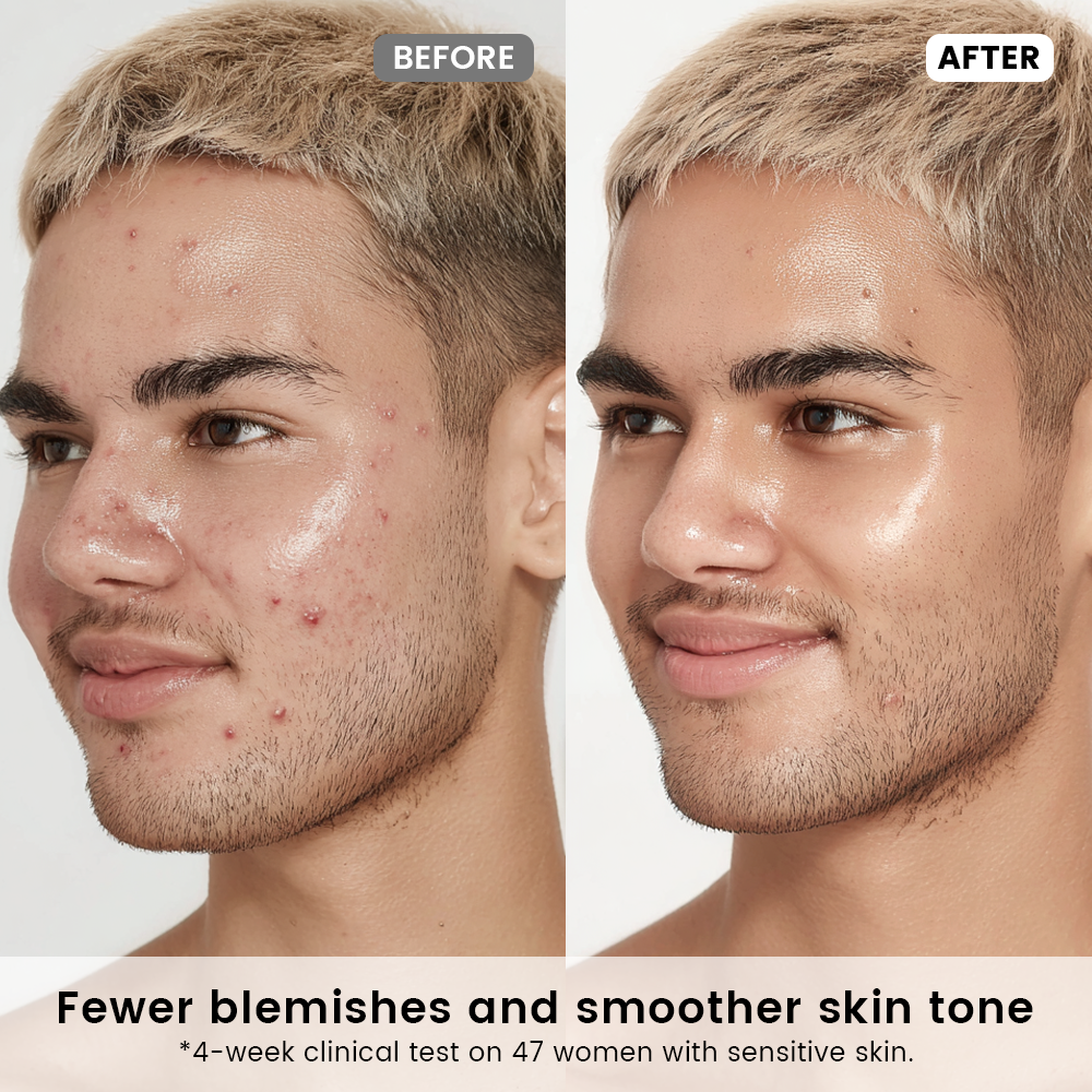Radiance Recovery Set