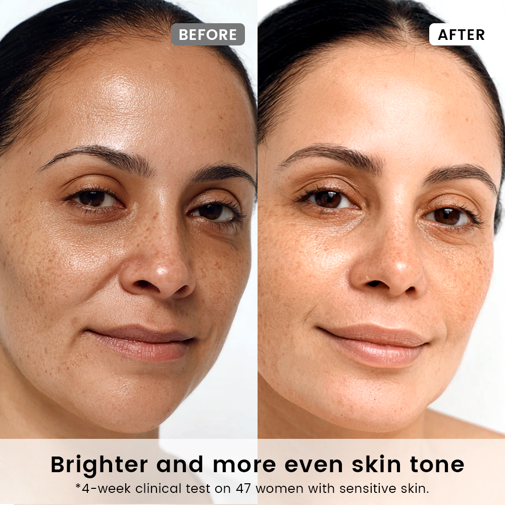 Glow On Set – Fade Acne Marks & Restore Radiance | Alra – Alra