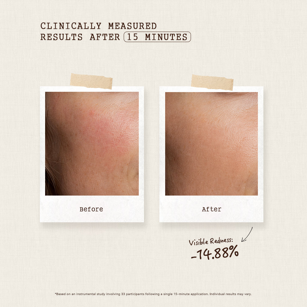Clinically measured results for ALRA Olive Pro Mask after 15 minutes: visible redness decreased by 14.88%. Based on an instrumental study involving 33 participants after a single 15-minute application. Individual results may vary.