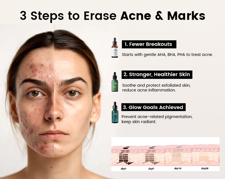 Alra 3-step skincare routine to help reduce acne marks and brighten skin