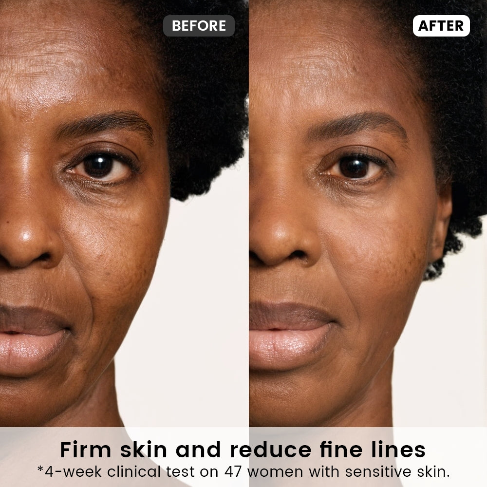 Alra Anti-aging Set