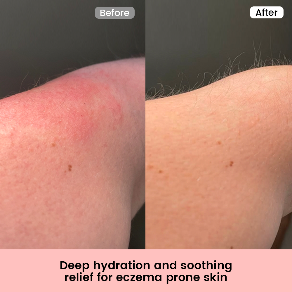 Alra Therapy Lotion
