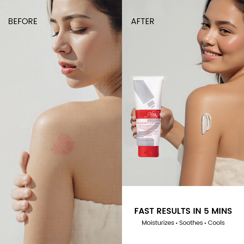 Loción Alra Therapy (compre una y obtenga un 50 % de descuento en la segunda) 