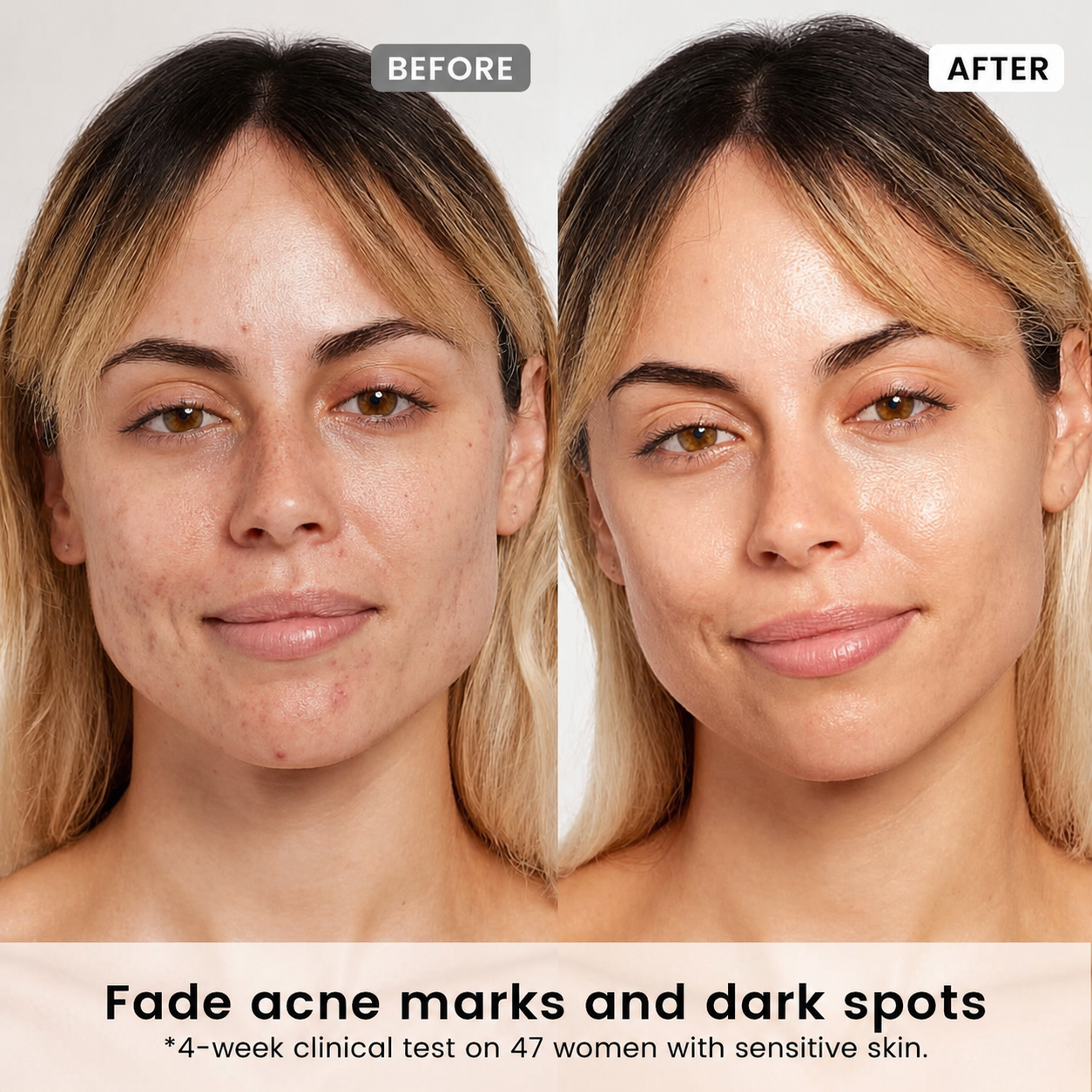Alra Dark Spot Correcting Serum