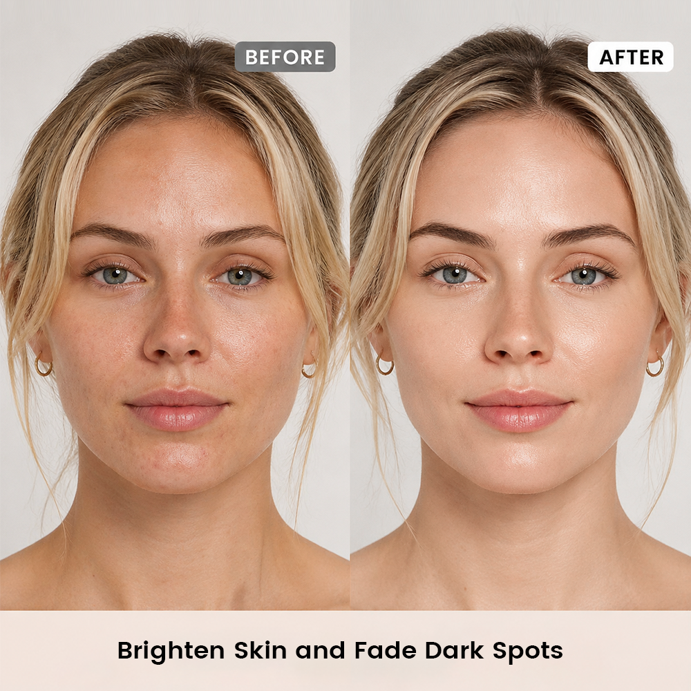 Alra Dark Spot Correcting Serum | Brightening Serum for Dark Spots, Sun Spots & Sensitive Skin