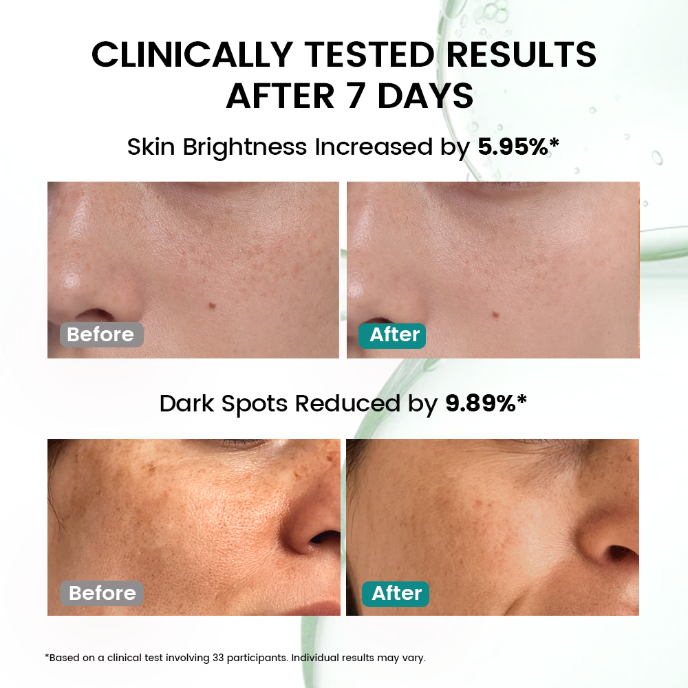Alra Dark Spot Correcting Serum | Brightening Serum for Dark Spots, Sun Spots & Sensitive Skin