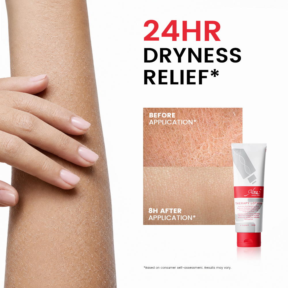 Loción Alra Therapy (compre una y obtenga un 50 % de descuento en la segunda) 