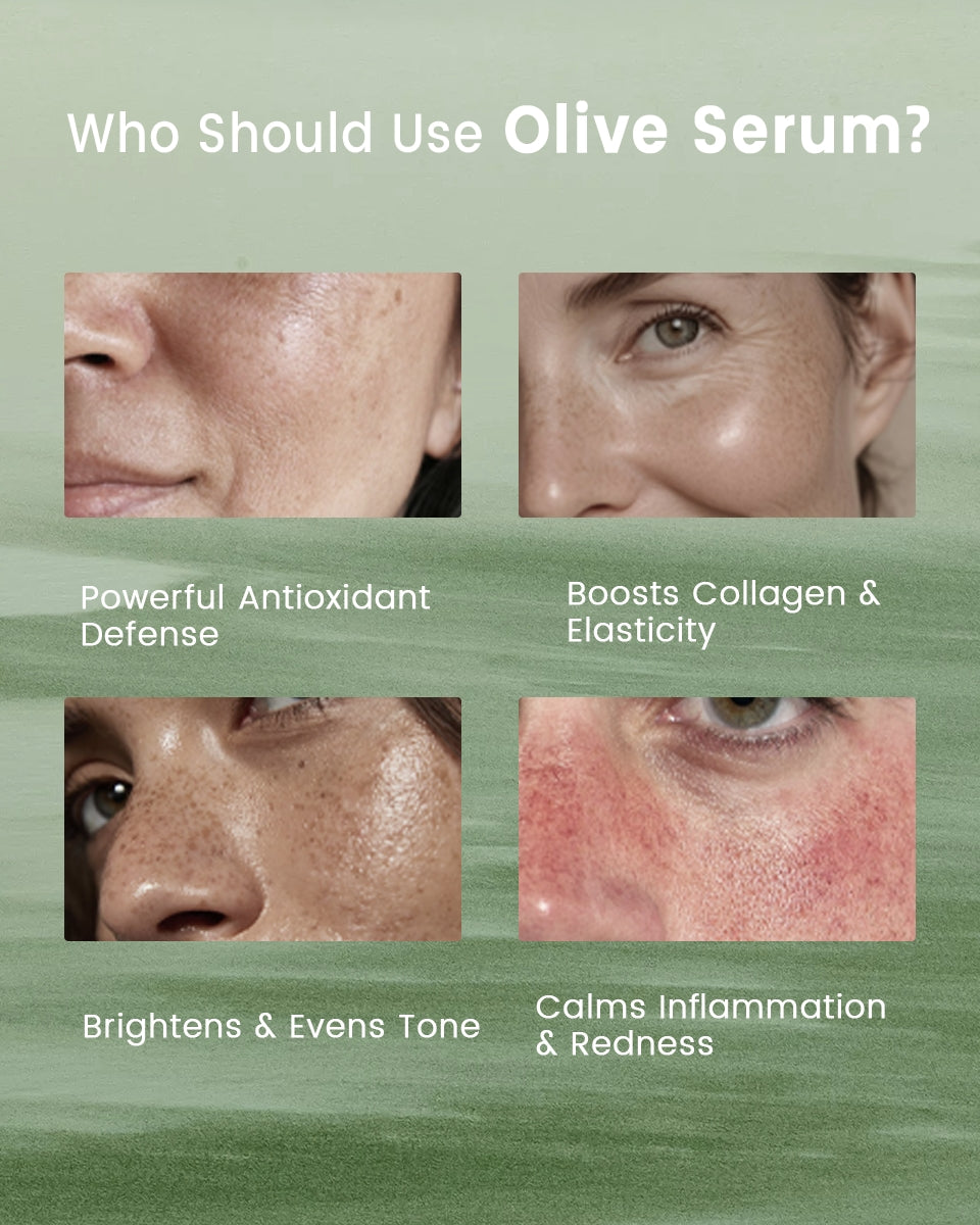 Illustration showing recommended uses of Alra Olive Serum, with text beneath the image highlighting its benefits: Brightens & Evens Tone (for post-acne marks), Powerful Antioxidant Defense (for dull skin), Boosts Collagen & Elasticity (for fine lines), and Calms Inflammation & Redness (for redness and acne).